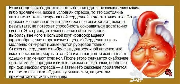 Может быть кашель от желудка у взрослых. Кашель при сердечной недостаточности. сердечная недостаточность кашель. одышка и кашель при сердечной недостаточности. сердечный кашель симптомы.