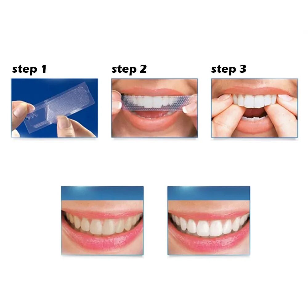 Отбеливание зубов. Отбеливающая полоска для зубов. Со скольки лет отбеливают зубы. Со скольки лет отбеливают зубы. Отбеливание зубов до и пос.