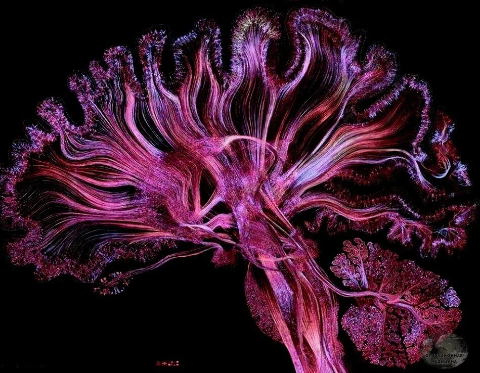 Нейронная сеть человеческого мозга. Грег Данн картины. Грег Данн Нейроны. Снимки головного мозга Greg Dunn. Нейронная сеть человека под микроскопом.