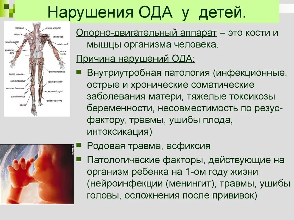 Нарушение двигательной системы. Причины нарушения опорно-двигательного аппарата. нарушения опорно-двигательного аппарата у дошкольников.. причины нарушений опорно-двигательного аппарата у детей. дети с нарушением опорно двигательного аппарата.
