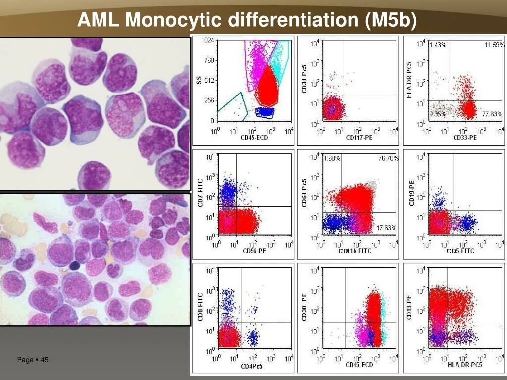 Aml проверка cryptozen. Цитометрия. Проточная цитометрия. Проточная цитометрия т лимфоциты. Флюоресцентная цитометрия микробиология.