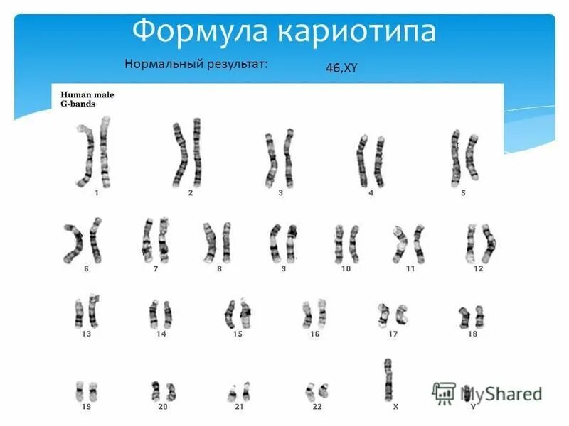 Кариотип 46 XY. Мужской кариотип 46 XY. Формула кариотипа. 46,XY нормальный мужской кариотип. Цитогенетический метод наследственные заболевания