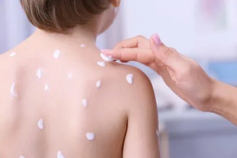 Чем мазать кожу ребенку