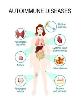 Immune system diseases