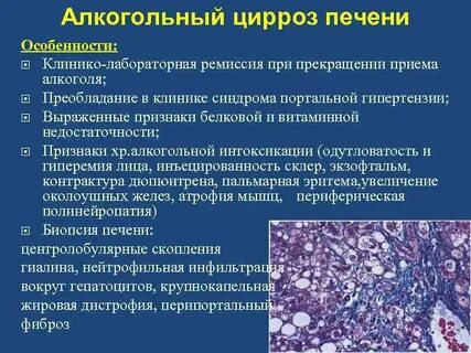 Вылечивается ли цирроз