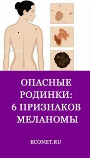 Родинки знаки