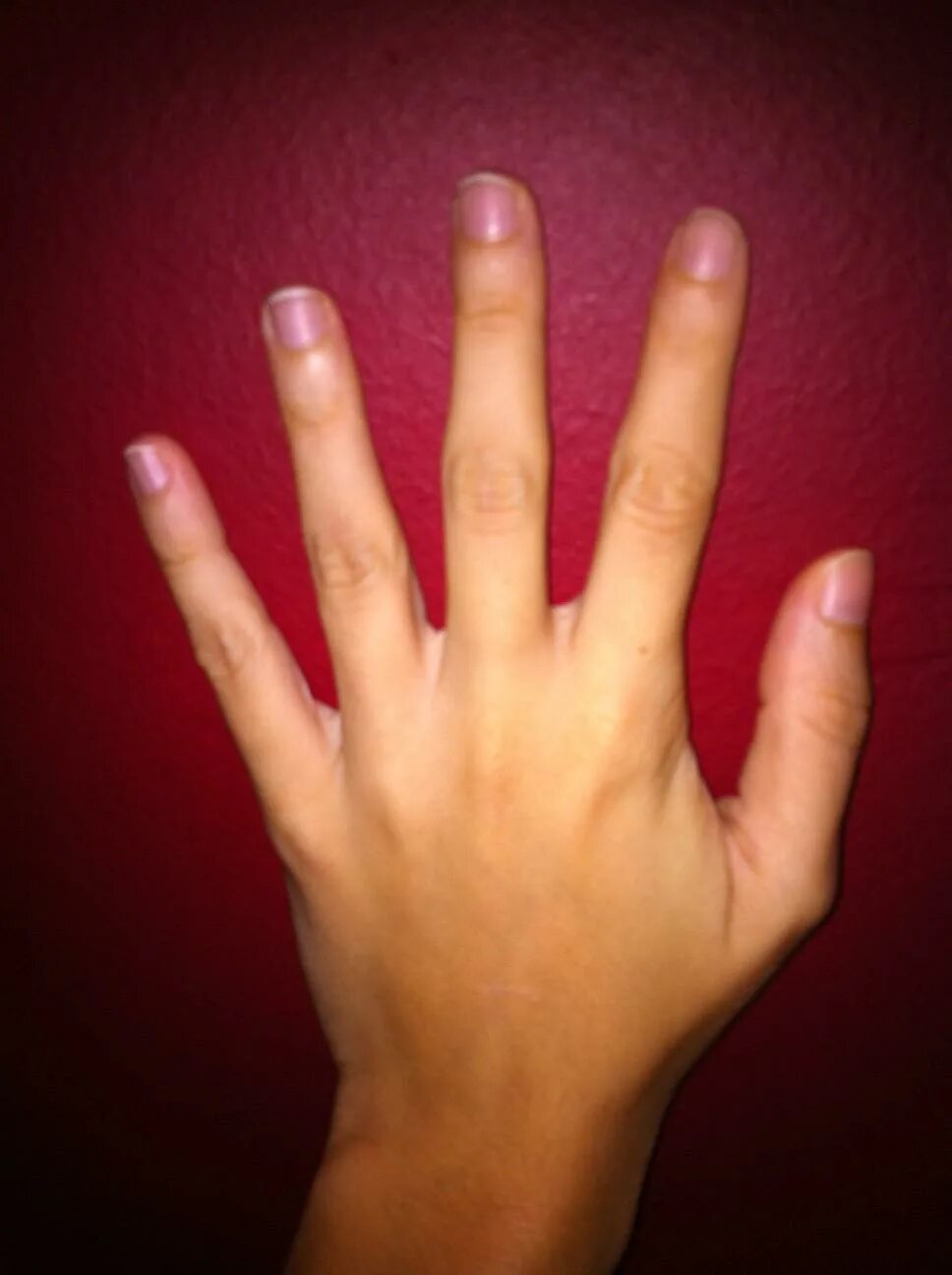 Палец толстый и большой. Квадратные пальцы.