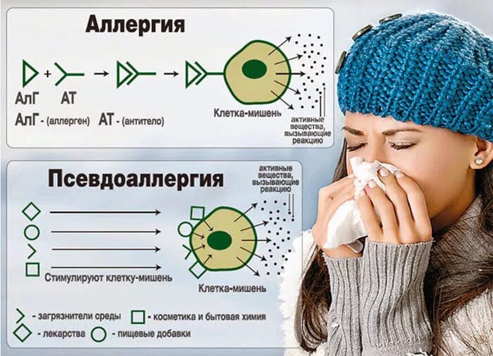 Аллергия и псевдоаллергия. Истинная аллергия и псевдоаллергия. Инфографика причины аллергии. Аллергическая реакция.