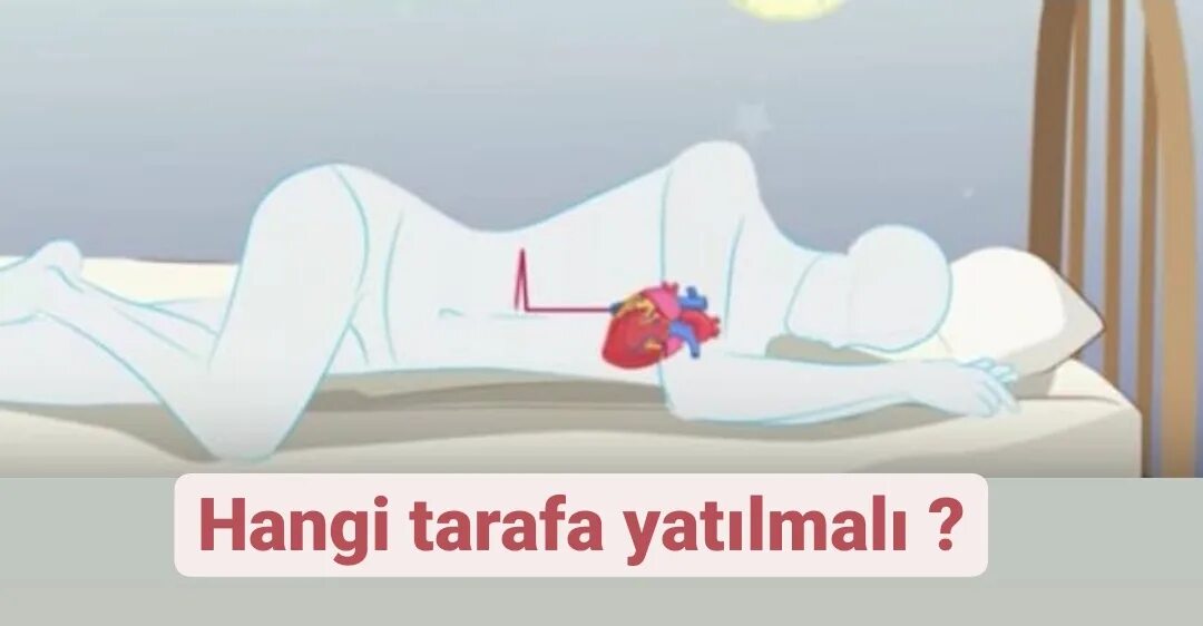 На каком боку спать при гастрите. Поза для сна при гастрите. изжога спать на левом боку. при гэрб спать на левом боку. лежать на левом боку при изжоге.