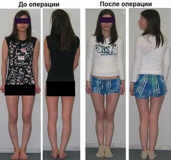 Исправление кривизны