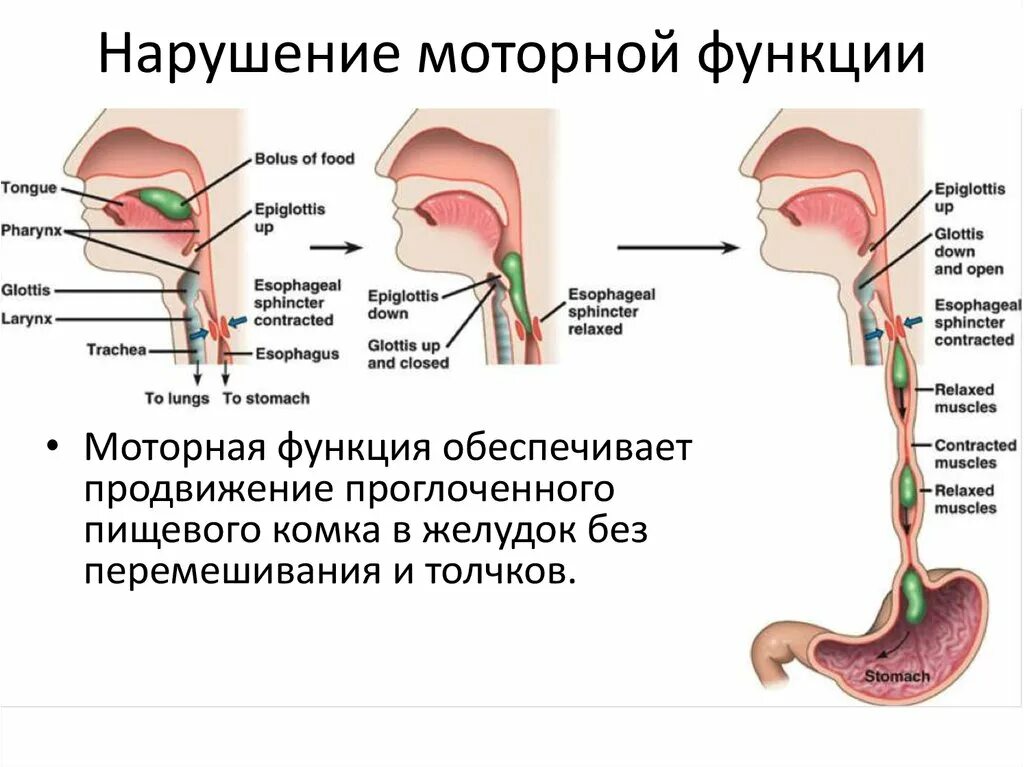 Расстройство двигательной функции. Нарушение моторных функций. Нарушение функций пищевода. Нарушение двигательной функции.