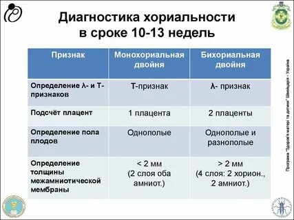 Монохориальную диамниотическую двойню