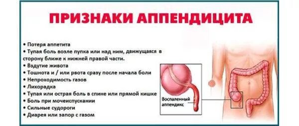 Запор болезненный. Запор болезненный