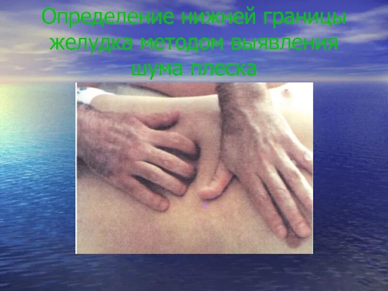 Методика определения нижней границы желудка. Симптом шума плеска при острой кишечной непроходимости. Шум плеска нижняя граница желудка. Шум плеска симптом. Пальпация поджелудочной железы пропедевтика.