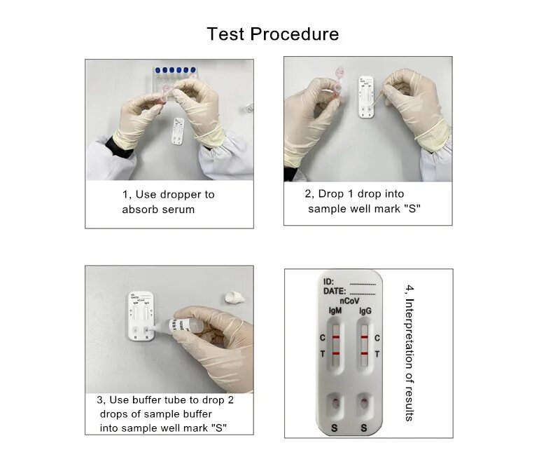 Тест мастурбатора. Положительный экспресс тест на Covid. Положительный экспресс тест на коронавирус. Результаты экспресс теста на коронавирус. Показания к тестированию на коронавирус.