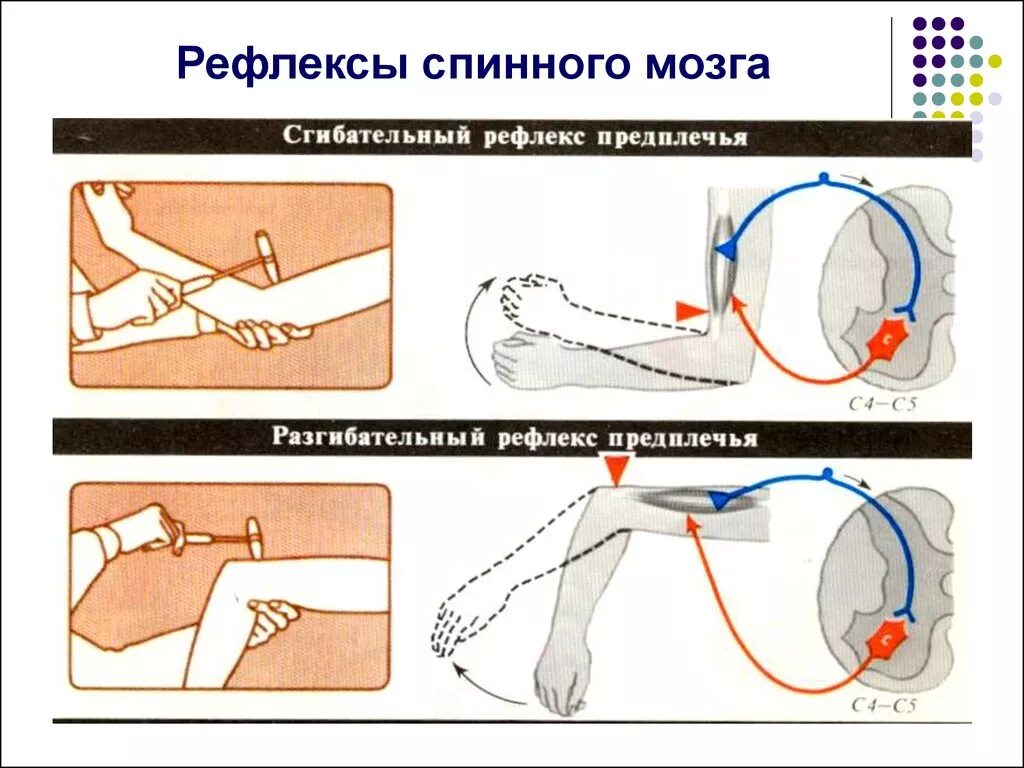 Спинальные сгибательные рефлексы. Разгибательный рефлекс предплечья. Сгибательные рефлексы спинного мозга. Схема дуги сгибательно-локтевой рефлекс,.