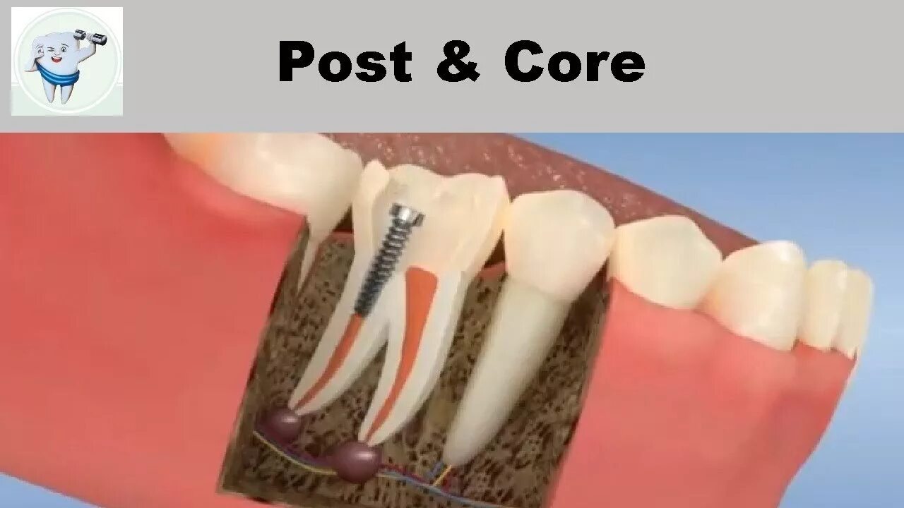 Core posting. Core posting