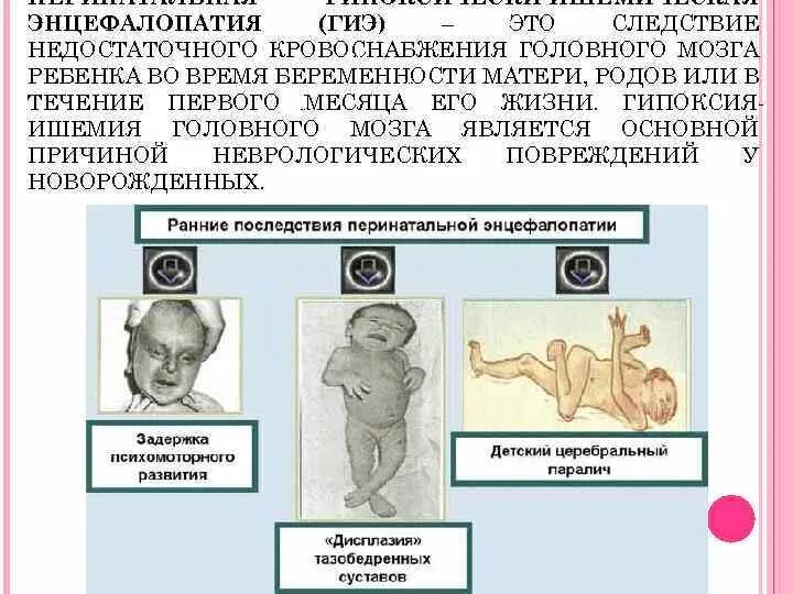 Энцефалопатия головного мозга последствия. Гипоксическая ишемическая энцефалопатия новорожденного. Энцефалопатия у детей симптомы. Энцефалопатия у новорожденных. Перинатальная энцефалопатия у новорожденных.