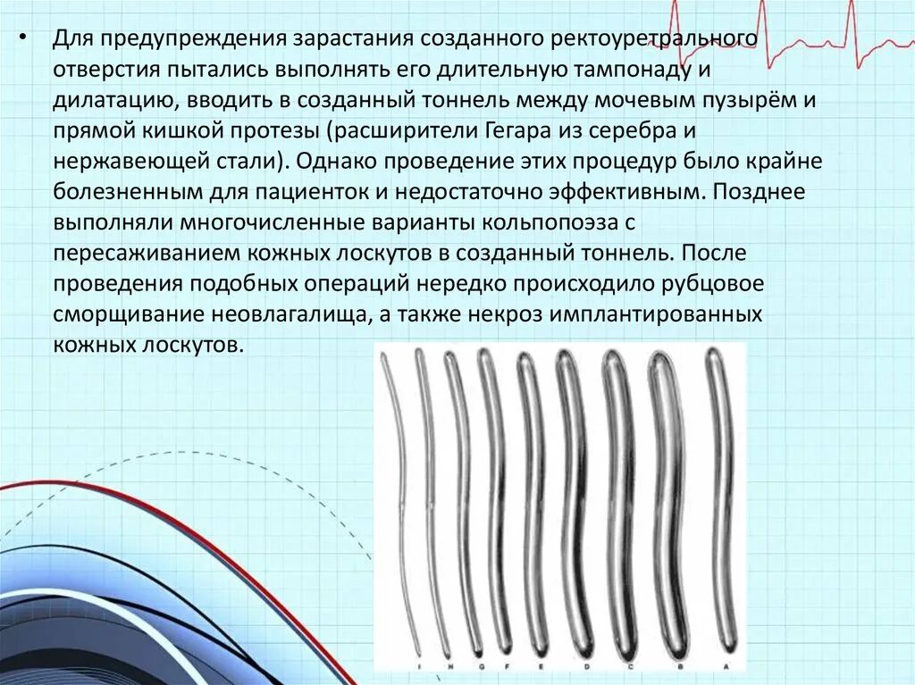 Дилататор это. Расширители гегара. бужи.. расширитель гегара для прямой кишки. дилататоры гегара. бужи гегара для прямой кишки.