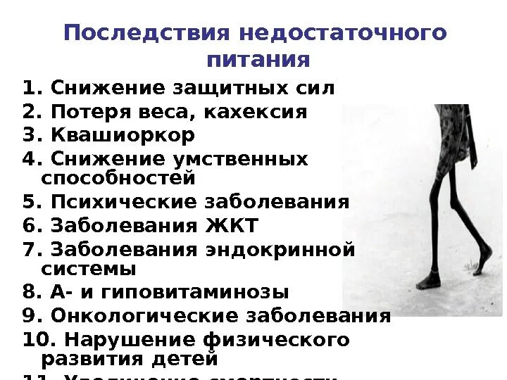 К чему приводит голод. Последствия недостаточного питания. Болезни, вызванные недоеданием. Недоедание последствия.