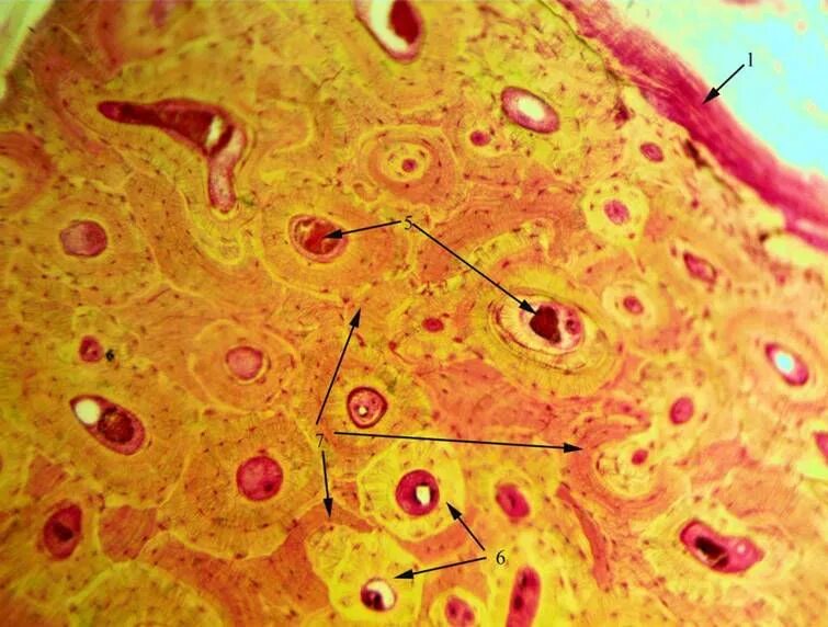 Остеон гистология. Остеон препарат гистология. Вставочные пластинки костной ткани. Периост гистология.