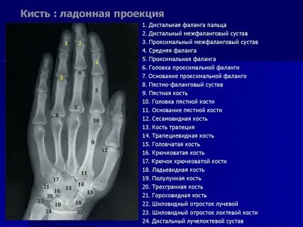 Лучезапястный сустав сколько
