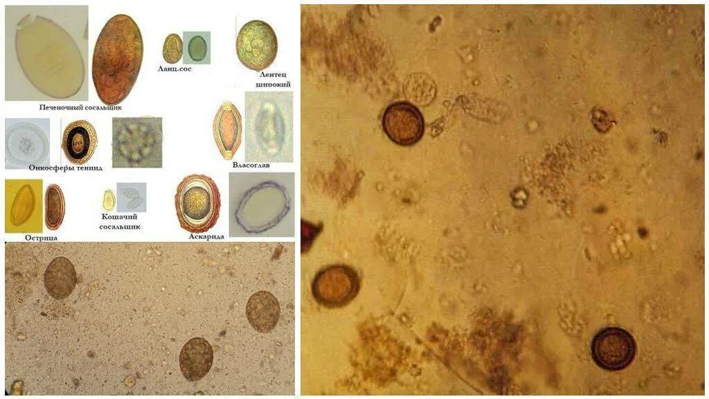 Яйца гельминтов микроскопия. Яйца гельминтов микроскопия атлас. Простейшие в кале лечение