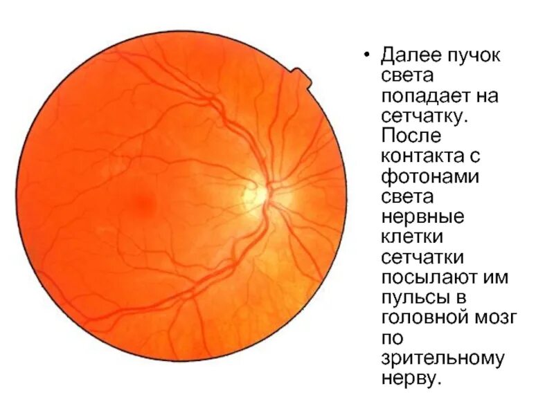 Офтальмоскопия глазного дна норма. Глазное дно норма рисунок. Офтальмоскопия картина нормального глазного дна. Нервные клетки сетчатки. Сетчатка ткань