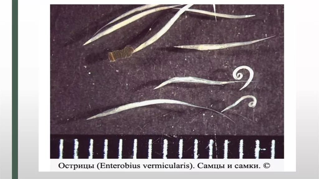 Глисты энтеробиоз острицы. Инкубац период энтеробиоз. Гельминтоз энтеробиоз аскаридоз. Острица детская enterobius vermicularis. Энтеробиоз острицы у детей.