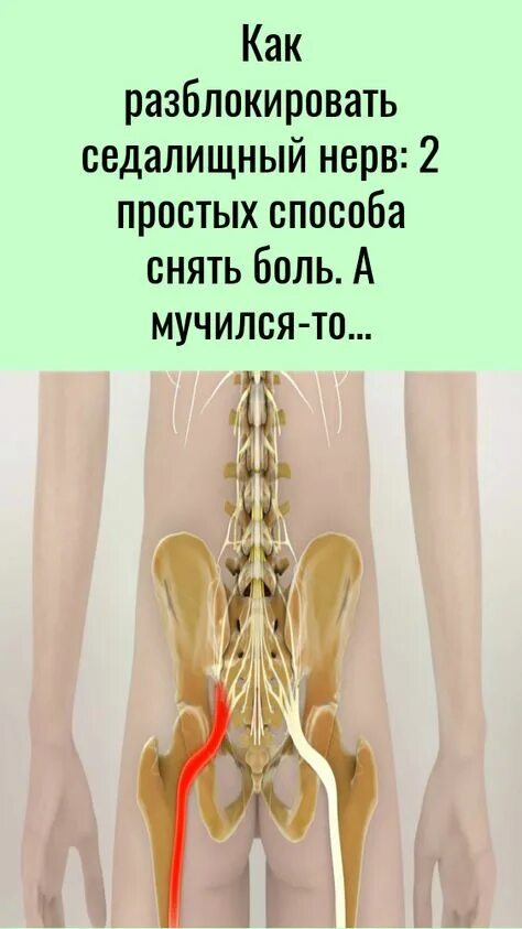 Седалищный нерв где он находится. Седалищный нерв. разблокирование седалищного нерва. как разблокироватьседалишний нерв.