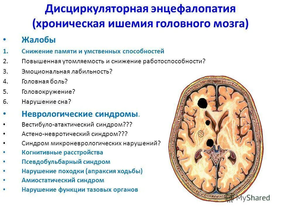 Энцефалопатия головного мозга симптомы у взрослых лечение
