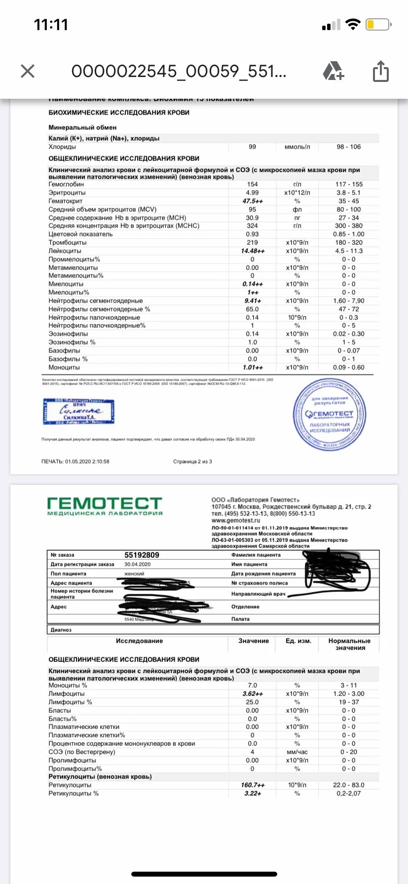 Общий анализ крови ретикулоциты норма. Ретикулоциты в клиническом анализе крови. Общий анализ крови ретикулоциты расшифровка. ОАК ретикулоциты анализ крови. Ретикулоциты повышены у мужчины