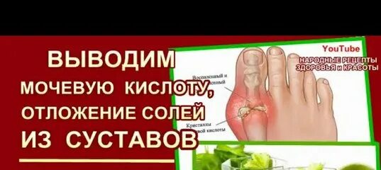 Травы выводящие мочевую кислоту из организма. Отложение солей мочевой кислоты. Средство от мочевой кислоты в суставах. Препараты от мочевой кислоты в суставах. Отложение солей в суставах.