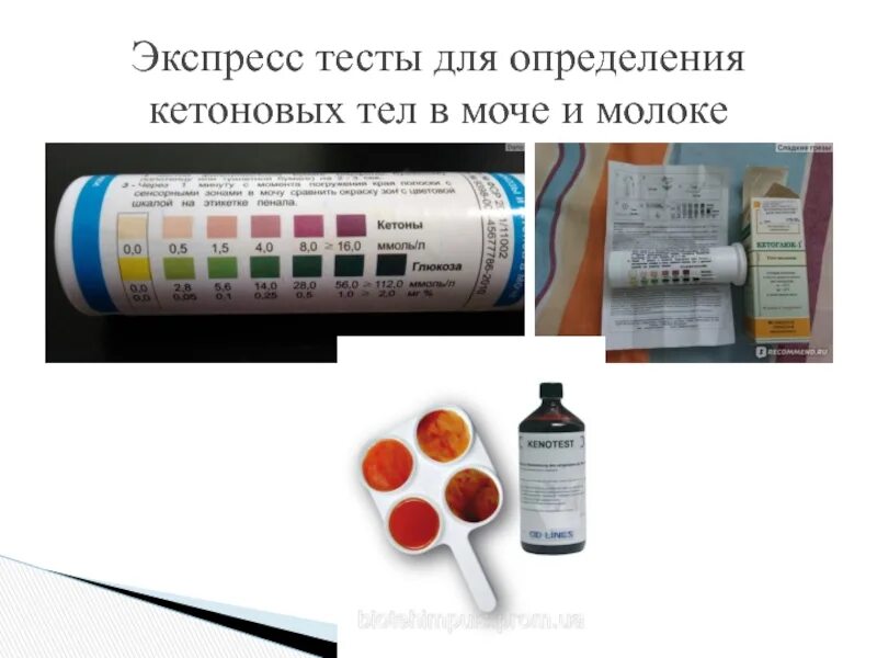 Повышенные кетоны в моче. Кетоновые тела в моче показатели. Алгоритм экспресс диагностики в моче Глюкозы и кетоновых тел. Исследование мочи на кетоновые тела. Определение кетоновых тел в моче тест.