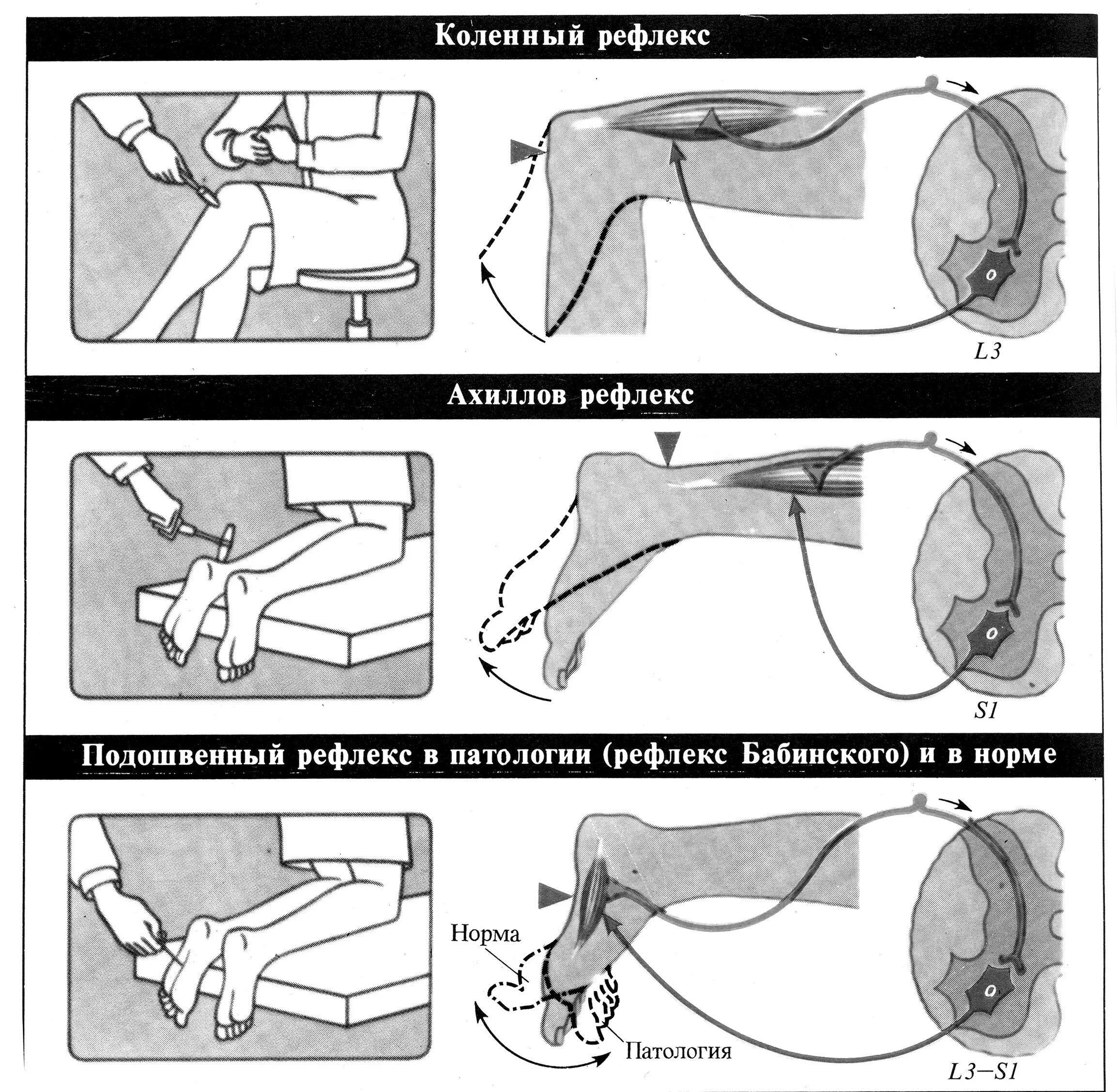 Коленный и Ахиллов рефлексы. Ахиллов рефлекс. Ахиллов рефлекс моносинаптический. Ахиллов рефлекс рефлекторная.