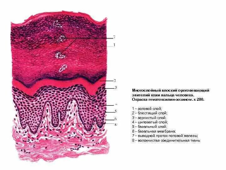 Многослойный плоский ороговевающий эпителий эпидермис кожи пальца. Плоский ороговевающий эпителий эпидермис кожи. Препарат многослойный плоский ороговевающий эпителий эпидермис кожи. Многослойный плоский эпителий гематоксилин-эозин.