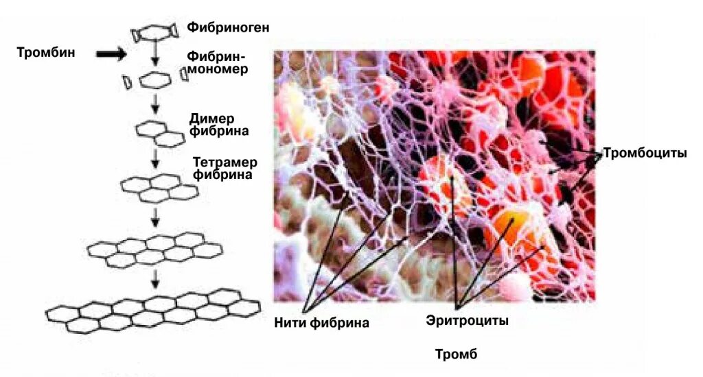 Количество фибрина после пореза. Фибрин и тромбин. Фибрин фибриноген протромбин. Препараты тромбина и фибриногена. Механизм образования фибрина и фибриногена.