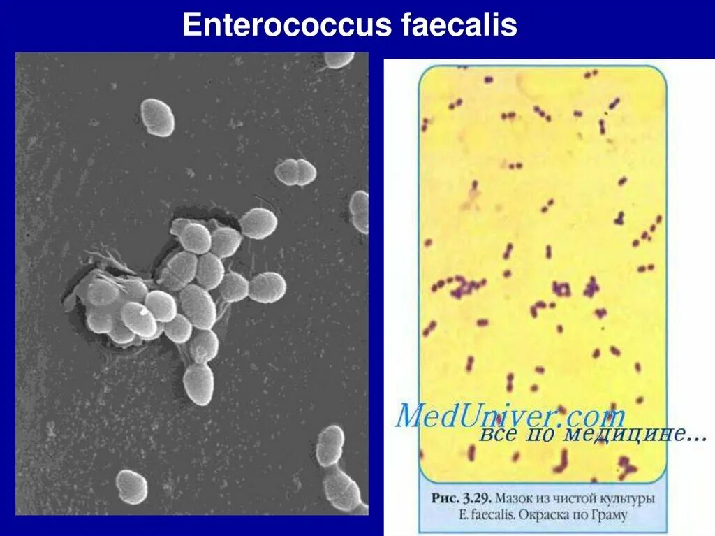 Streptococcus в мазке у мужчин. Энтерококки микроскопия. Enterococcus faecalis мазок. Enterococcus faecalis аэроб. Энтерококки заразность.