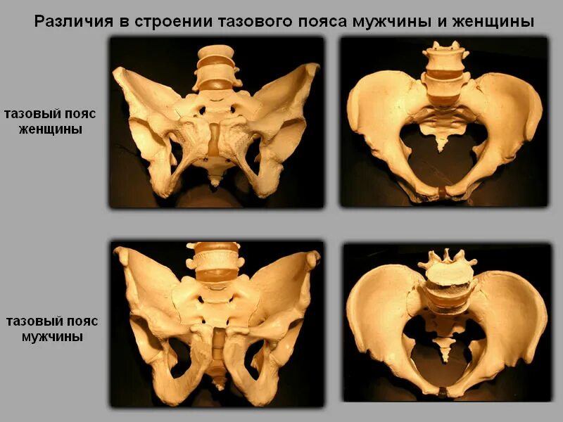 Мужской и женский таз ана. Мужской и женский таз анатомия. Строение мужского и женского таза. Скелет таз женский и мужской. Расширение таза мужчин