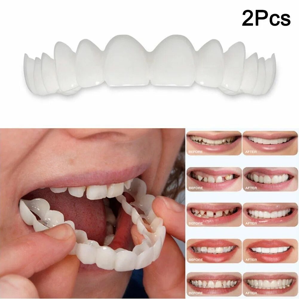 Сменные зубы. Виниры для зубов snapon smile (белый). зубные протезы виниры. накладки на зубы съемные. съемные виниры для зубов.