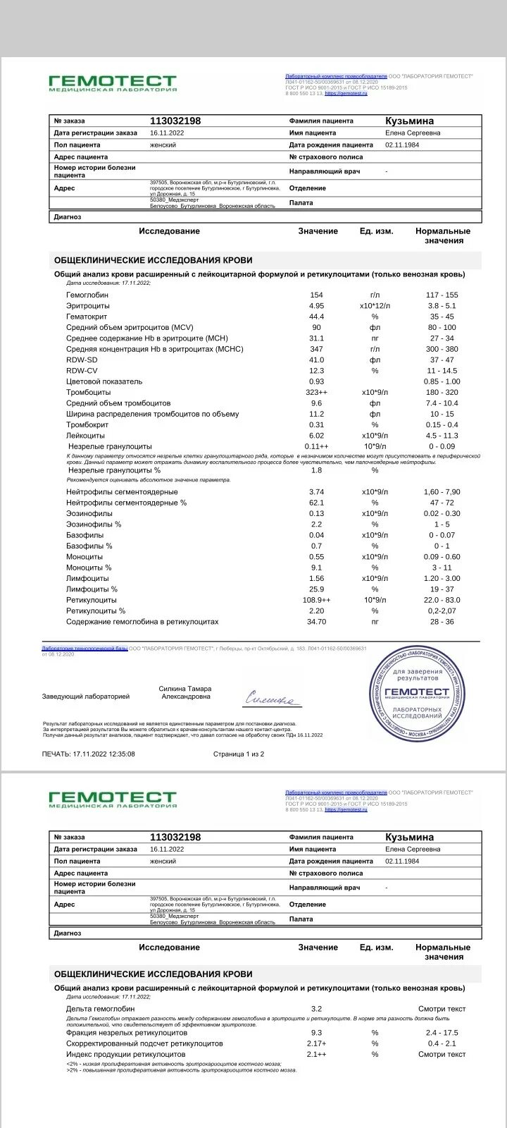 Ретикулоциты повышены. Ретикулоциты повышены