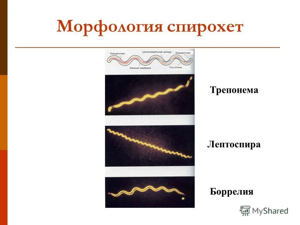 морфология и ультраструктура спирохет. риккетсии и спирохеты. морфология и ультраструктура спирохет. спирохеты основная характеристика. морфология спирохет.