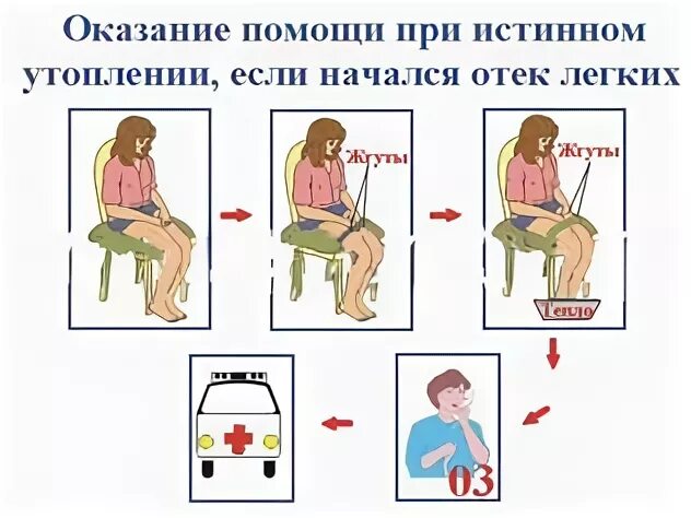 Оказание помощи при отеке легких алгоритм. Последовательность оказания помощи при отеке легких:. Первая помощь при отеке легких алгоритм действий. Отек легких неотложная помощь. Отек легких помощь алгоритм