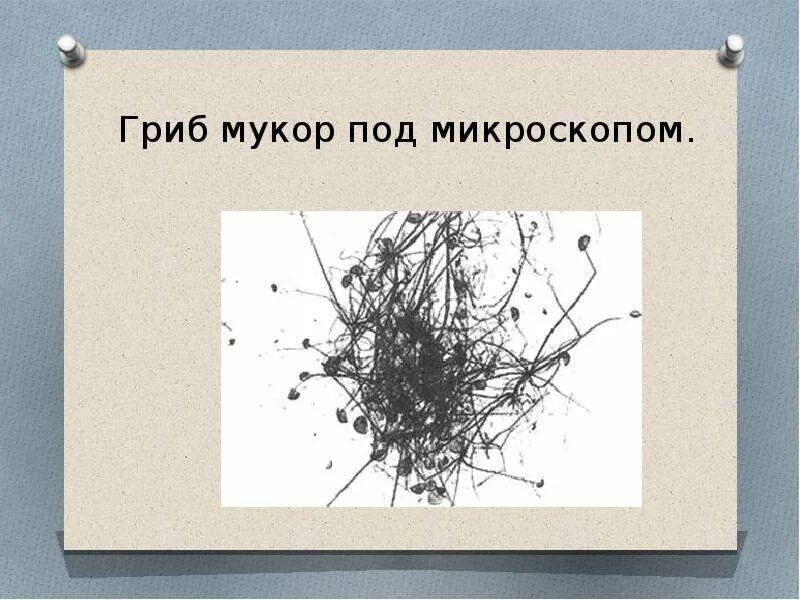 Каково значение гриба мукора в жизни. Плесень мукор под микроскопом строение. Гриб мукор под микроскопом рисунок. Строение гриба мукора 5 класс. Строение гриба мукора.