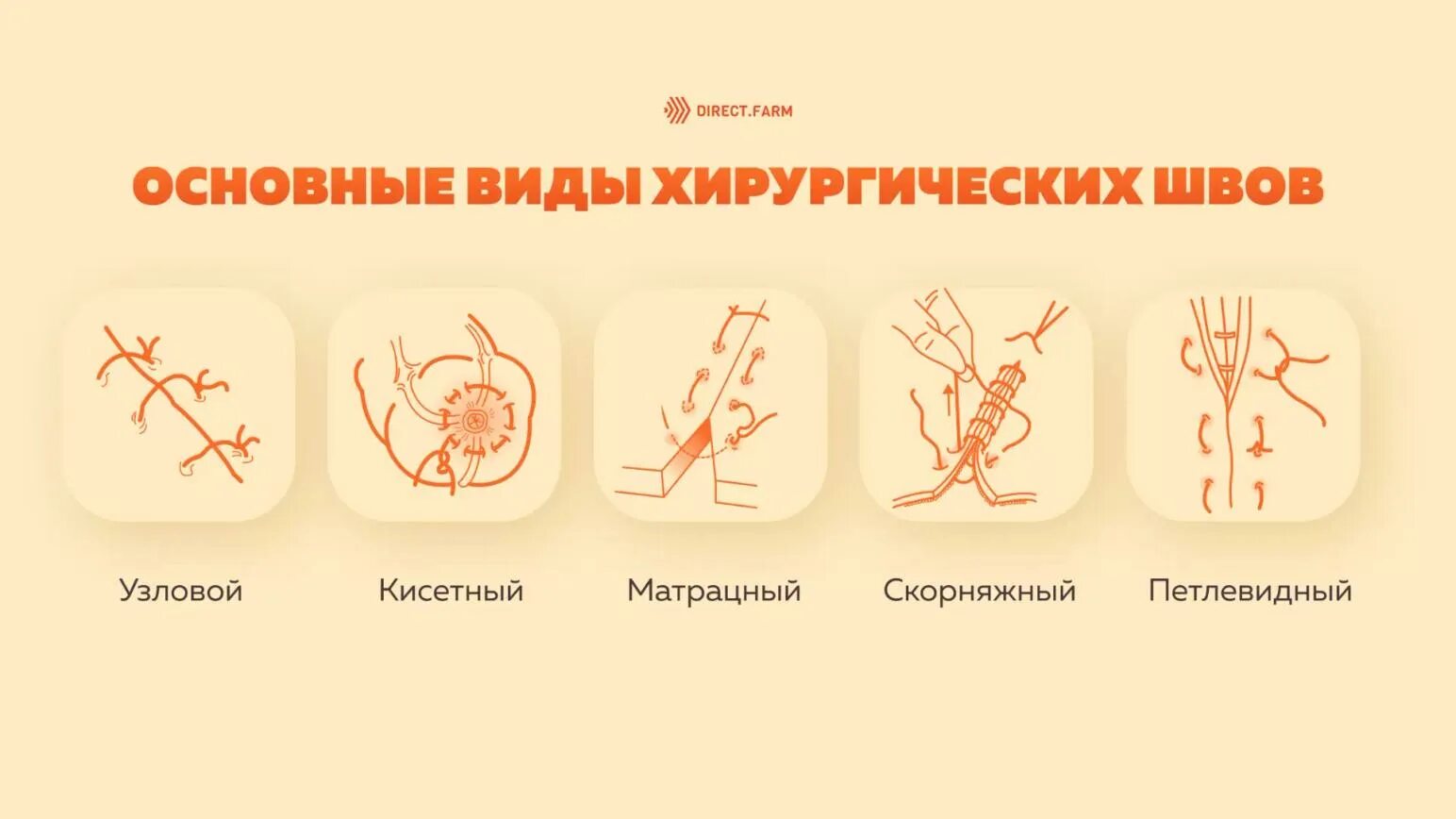 Техника наложения хирургических швов. Скорняжный шов хирургия. Матрасный шов в хирургии техника. Скорняжный шов хирургия Ветеринария. Виды хирургических швов классификация.