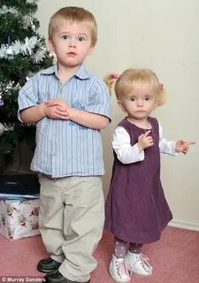 Синдром рассела сильвера