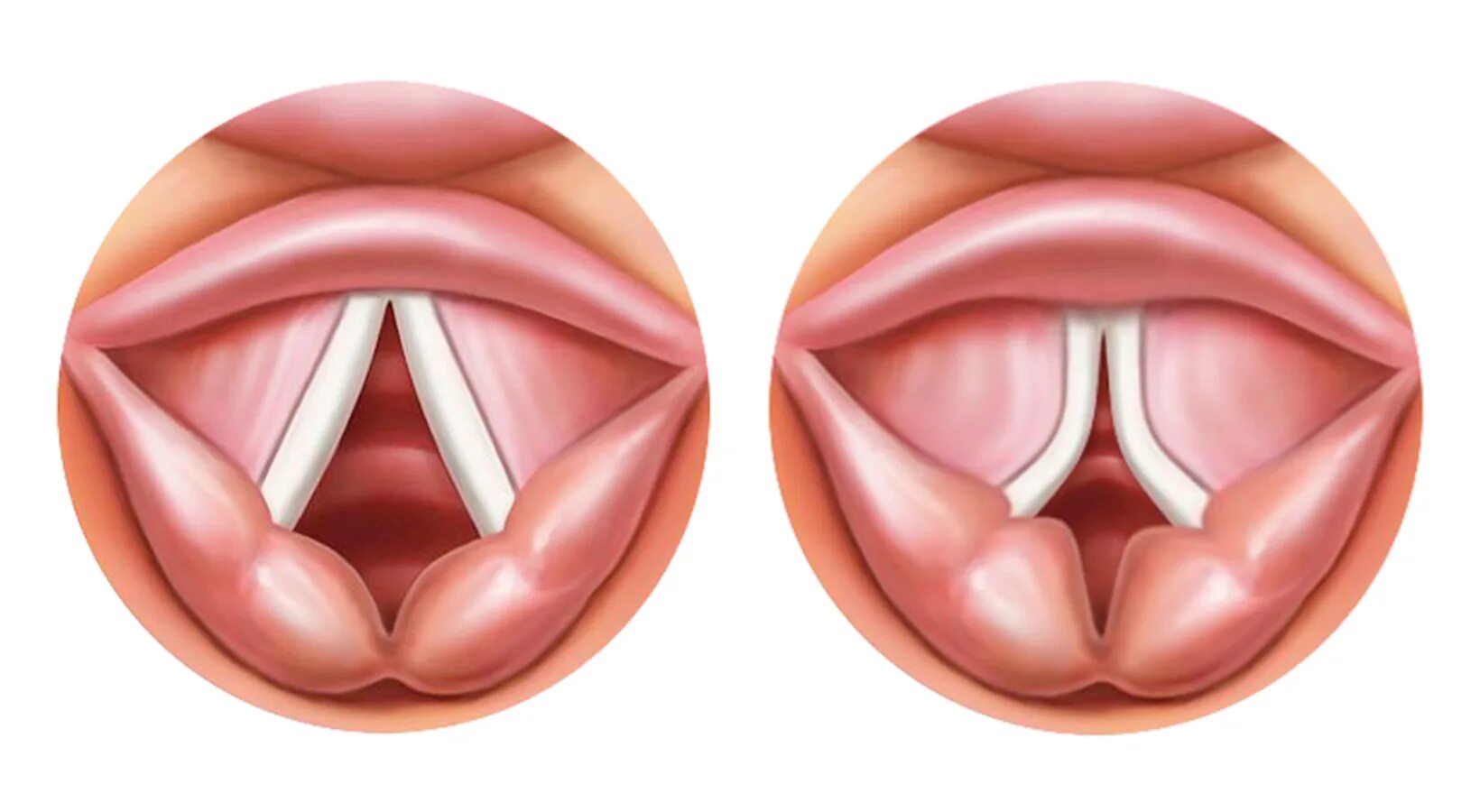 как выглядят голосовые связки человека при пении. голосовые связки анатомия строение. голосовые связки у человека. положение голосовых связок. говорю связками.