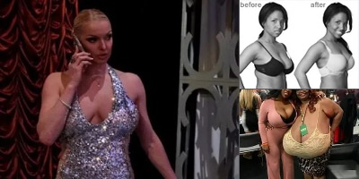 грудь 8 размера обвисшие