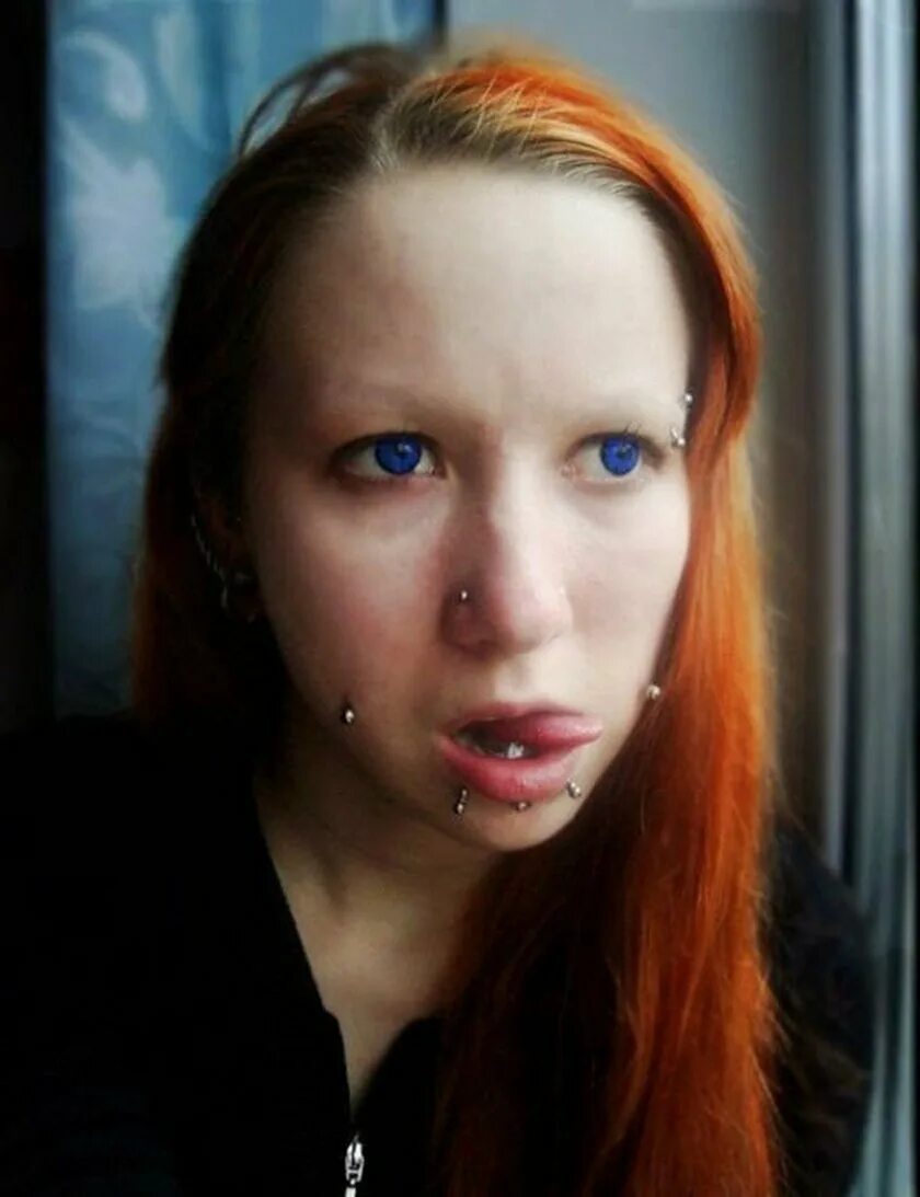 Веснушки эфелиды. Илька брюль. Очень некрасивые девочки. Очень некрасивые девочки. Очень некрасивые девочки.