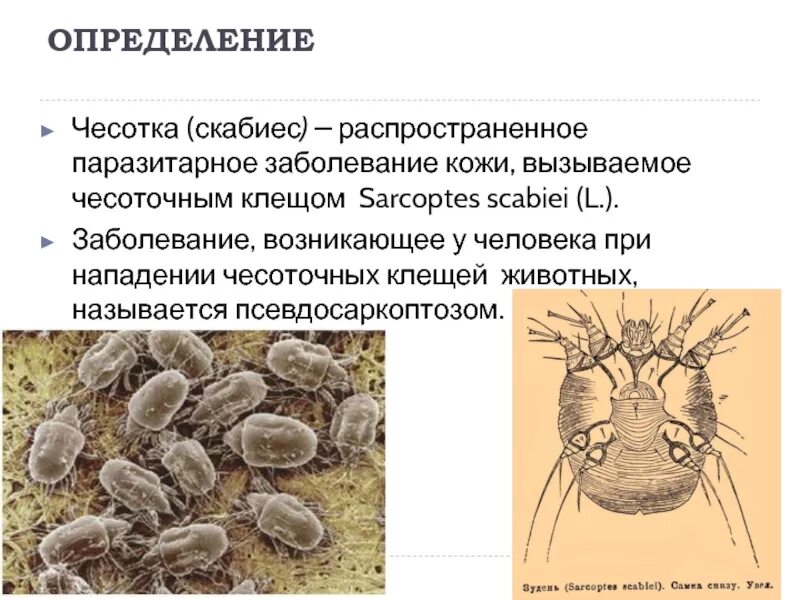 Выявление чесотки